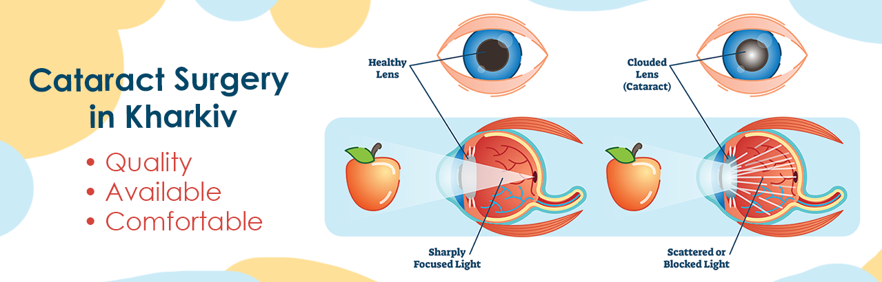 Chirurgie de la cataracte à Kharkiv