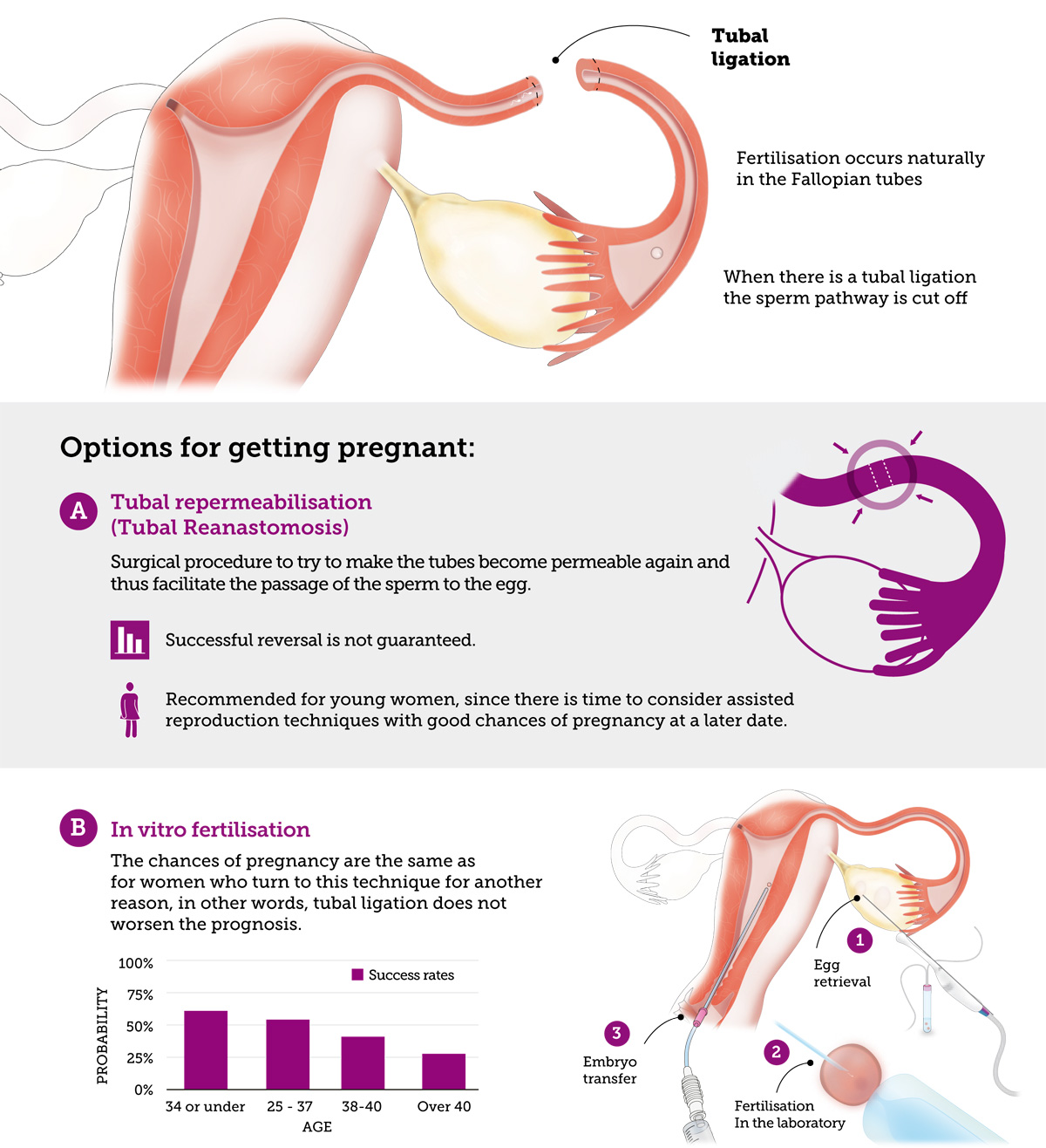 Infographie sur les chances de conception après une ligature des trompes