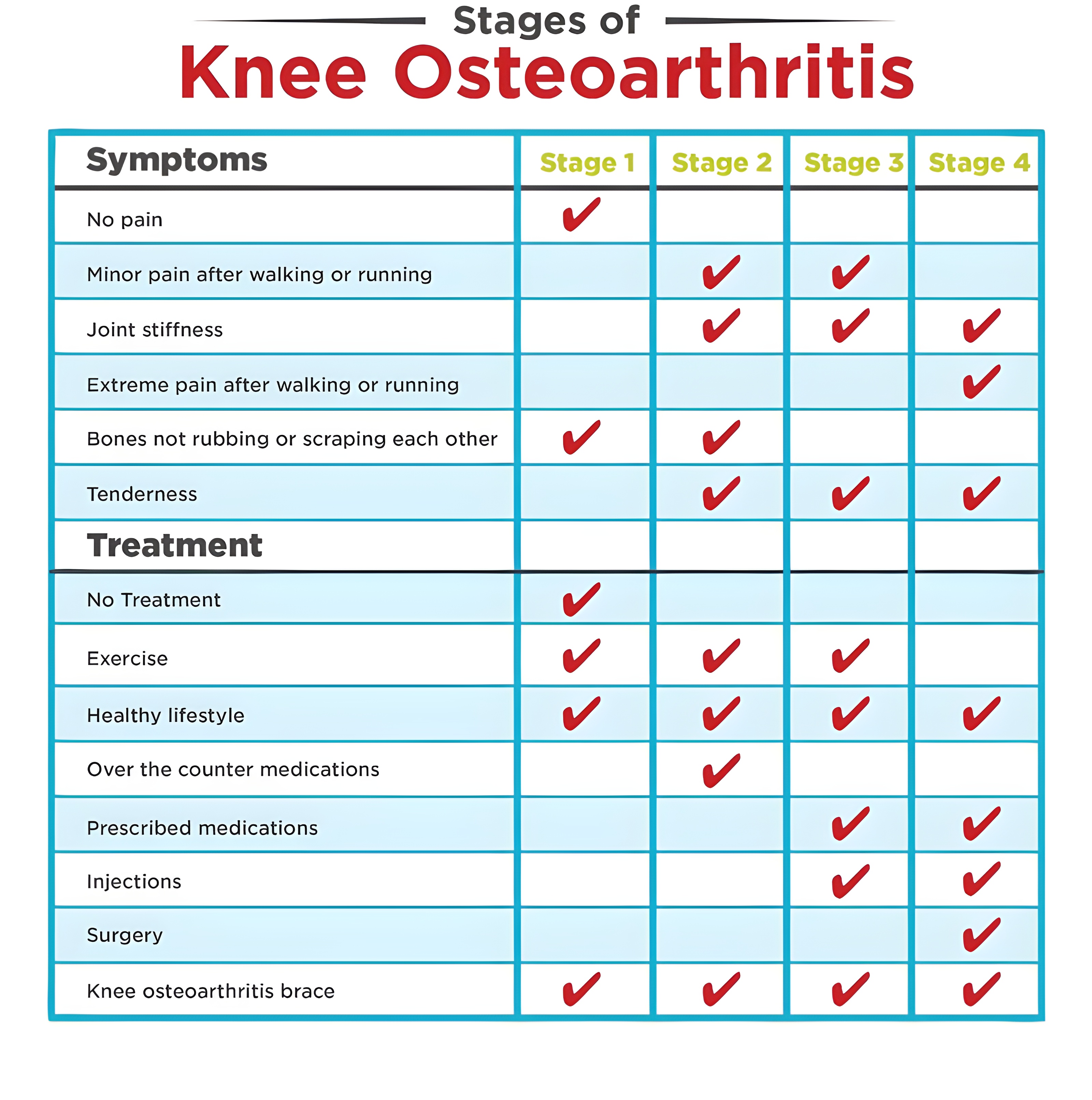 Tableau présentant les symptômes de l'ostéoarthrite à différentes étapes