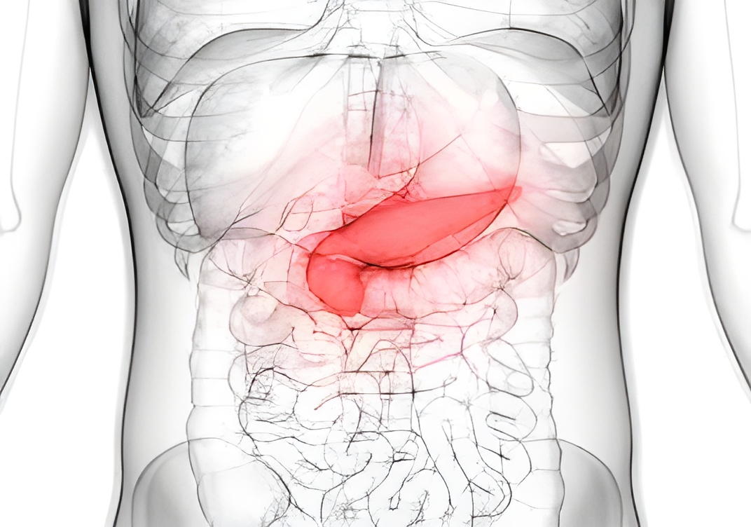 Symptômes du diagnostic de la pancréatite