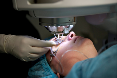 Chirurgie oculaire au laser en Ukraine