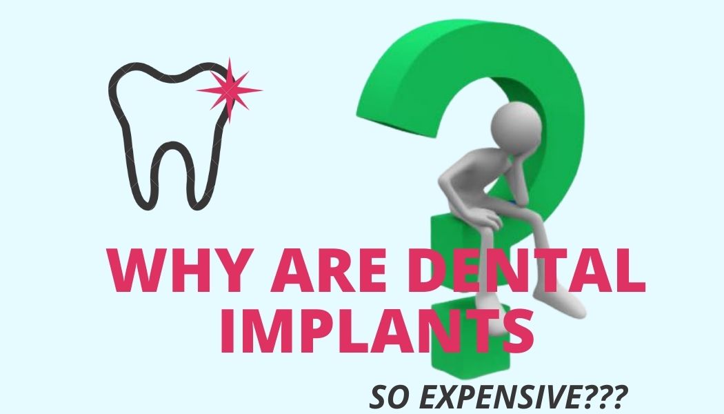 Pourquoi les implants sont-ils si chers ?